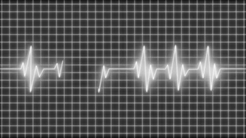 Electrocardiogram waveform across grid background animation Stock Footage 335117904