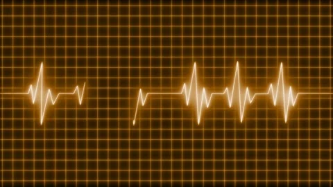 Electrocardiogram waveform across grid background animation Stock Footage 335117954
