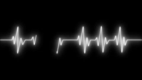 Electrocardiogram waveform across grid background animation Stock Footage 335117972