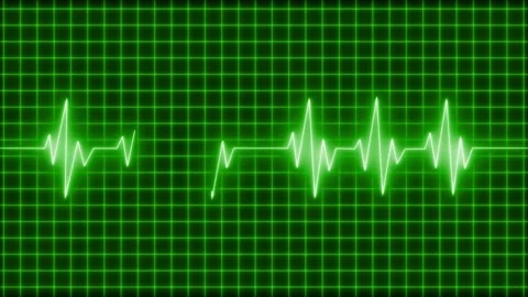Electrocardiogram waveform across grid background animation Stock Footage 335117983