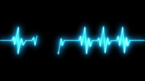 Electrocardiogram waveform across grid background animation Stock Footage 335117996