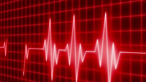 Electrocardiogram waveform across grid background animation Stock Footage 335118045