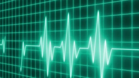 Electrocardiogram waveform across grid background animation Stock Footage 335118085