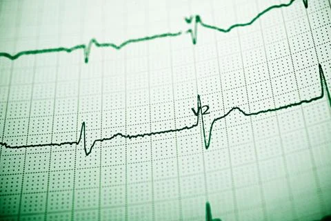 Electrocardiograph close up Stock Photos