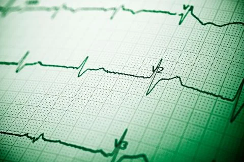 Electrocardiograph close up Foto stock