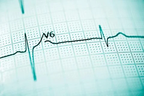 Electrocardiograph closeup view Фото