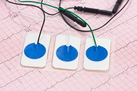 Electrocardiograph Foto stock