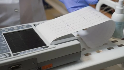 Electrocardiograph is working, printing the cardiogram test for cardiologist Video stock 121625282