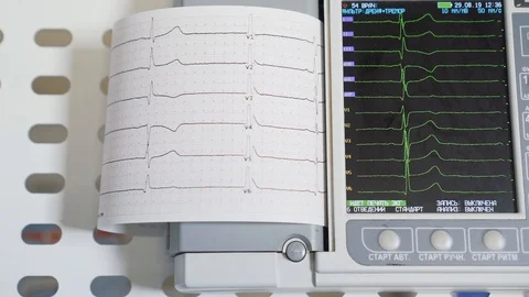Electrocardiograph is working, printing the cardiogram test. Stock Footage 121625308