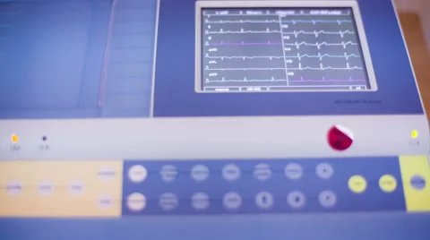 Electrocardiography 01 HD Stock Footage 47580873