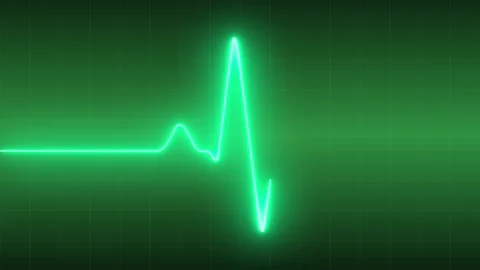 Electrocardiography Display of Heartbeat Waveform Stock Footage 296315173