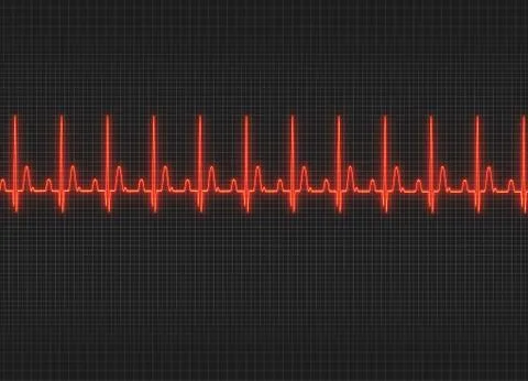 Electrocardiography Stock Illustration