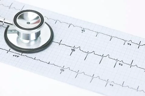 Electrocariograph Foto stock