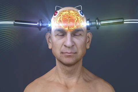 Electroconvulsive therapy, ECT, a treatment used for severe mental illnesses  Illustrazione stock