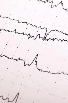 Electroencephalogram graph on white paper close up Stock Photos