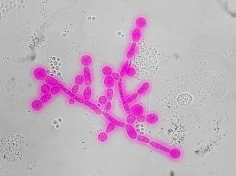 Electron micrograph of Candida chlamydospores Stock Photos