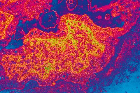 Electron micrograph of a cell nucleus at high magnification Stock Photos