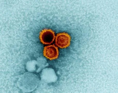  An electron micrograph showing three Epstein-Barr virus (EBV) particles c... Stock Photos