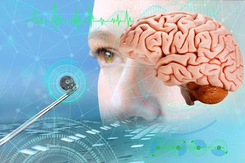 Electronic chip, bug in scientist's hand, Successful implantation of wirele.. Stock Photos