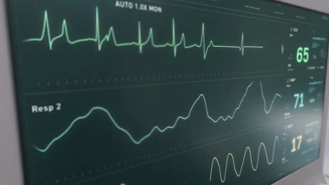 Ecg Flatline Stock Video Footage | Royalty Free Ecg Flatline Videos | Pond5