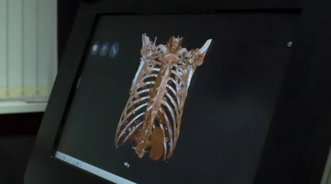 Electronic X-rays Stock Footage 67463286