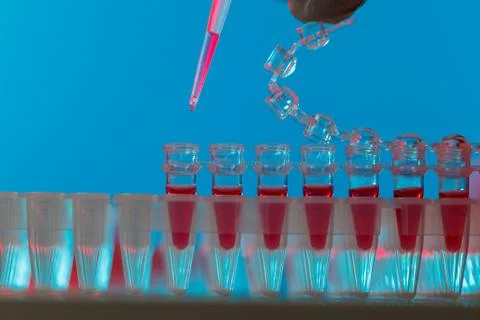 Electrophoresis device in a genetics lab to decrypt the genetic code Foto stock