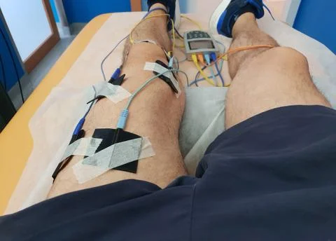 Electrostimulation of the quadriceps as a physiotherapy therapy Stock Photos