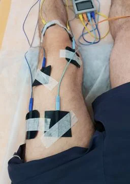 Electrostimulation of the quadriceps as a physiotherapy therapy Stock Photos