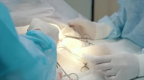 Electrosurgery tool in surgeon's hand Video stock 66728754