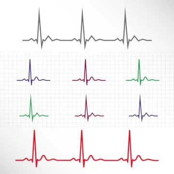 Elements and lines of normal ECG Illustrazione stock