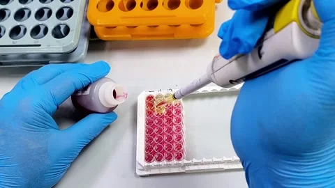 ELISA testing Video stock 337722885