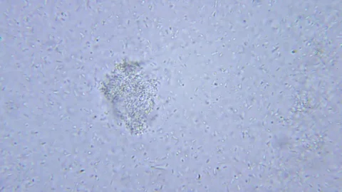 EMA bacteria under Bright field Microscope 스톡 동영상 80432885