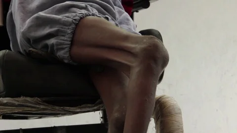Emaciated, disabled children in orphanage Stock Footage