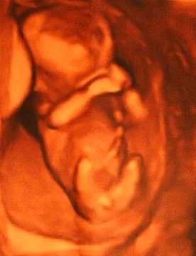 Embryo Stock Photos