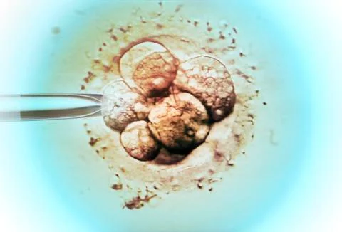 Embryo selection for ivf light micrograph Stock Photos