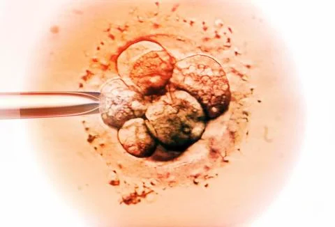 Embryo selection for ivf light micrograph Stock Photos