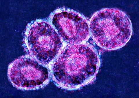  Embryonic stem cell Embryonic stem cell. Stem cells are undifferentiated ... Stock Photos