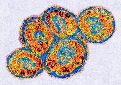  Embryonic stem cell Embryonic stem cell. Stem cells are undifferentiated ... Stock Photos