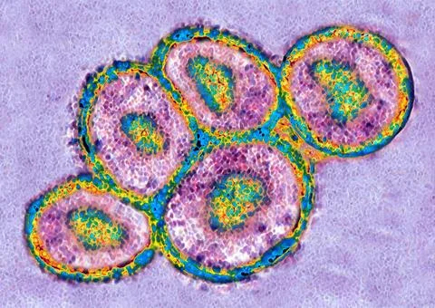  Embryonic stem cell Embryonic stem cell. Stem cells are undifferentiated ... Stock Photos