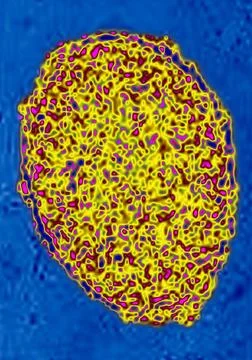  Embryonic stem cell Embryonic stem cell. Stem cells are undifferentiated ... Stock Photos