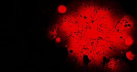 Emergency Blood Analysis 4K Видео 72377051