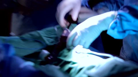 Emergency Catheterization room Surgery Close Up Stock Footage 44242980
