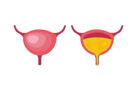 Empty and Full Urinary bladder. Vector cartoon flat anatomical icon color Stock Illustration