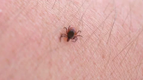 An encephalitic tick crawls on a person's arm. Macro Stock-Footage 154164197