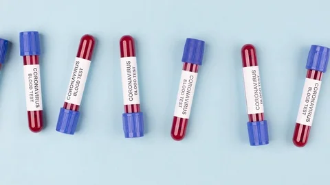 Endless moving test tubes of blood test on a blue background 스톡 동영상 126704549