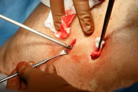 Endo-surgery instrument in usage Photos
