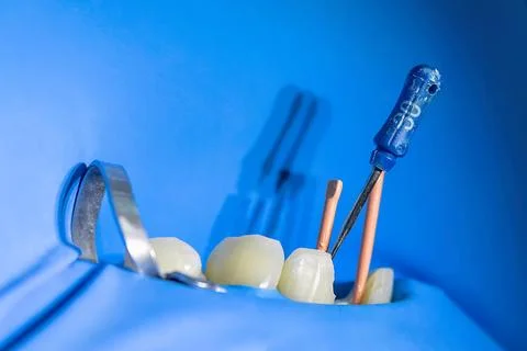 Endodontic files during root canal treatment under rubber dam isolation Stock Photos