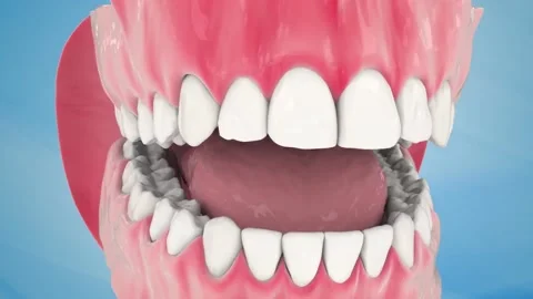 Endodontic root canal treatment process. Medically accurate tooth 3D animatio Stock Footage 220621062
