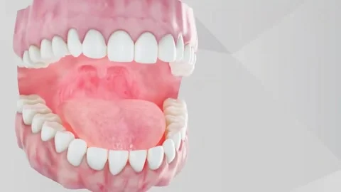 Endodontic root canal treatment process. Medically accurate tooth 3D animatio Stock Footage 220621508
