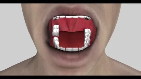 Endodontic root canal treatment process. Medically accurate tooth 3D animatio Stock Footage 220621667